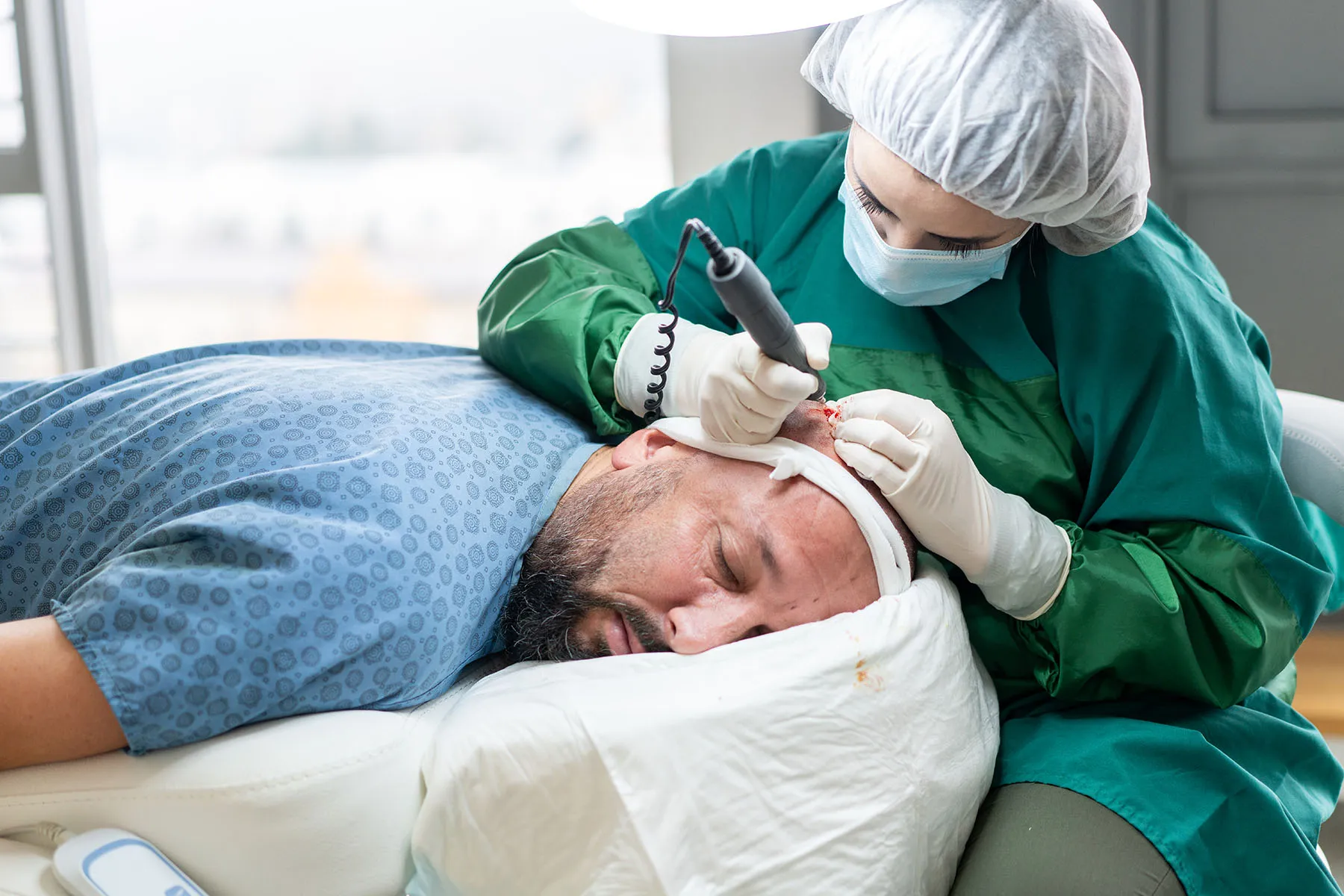 Hair Transplant Success Stories – Real-Life Transformations